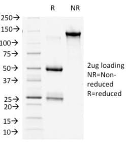 beta-Catenin Antibody (9F2), Novus Biologicals 20&mu;g; Unlabeled:Antibodies,